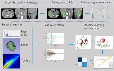 Machine Learning-Based CT Radiomics Method for Identifying the Stage of Wilms Tumor in Children